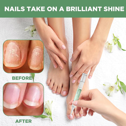 3 Pieces Nail Care Oil Pen, Nail Care Oil Pen Nourishing, Oil Pen for Nail Care, with Tea Tree Oil, Vitamin and Aloe Vera, Deeply Moisturizes and Nourishes