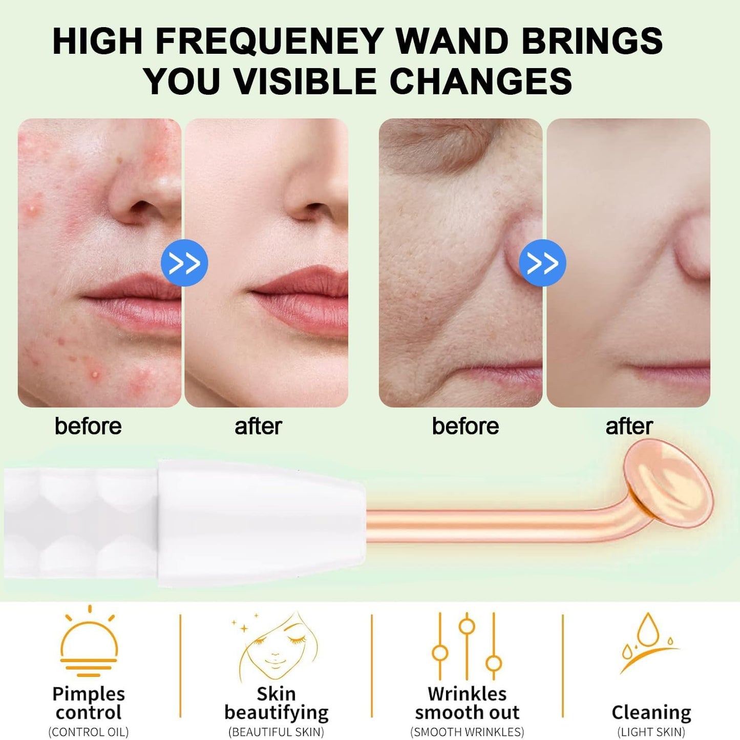 High Frequency Facial Wand, Portable High Frequency Facial Skin Machine, With 4 Different Tubes. Face Skin Therapy Wand, For Wrinkles, Skin Tightening, Dark Circles Under The Eyes (Orange)