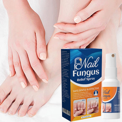 Nail Strengthener Spray, Toenail Care Treatments, 4.02x1.14in Gentle Long-Lasting Formula, Repair and Protect, Fast Absorbing Spray for Damaged Thickened Toenails Cares