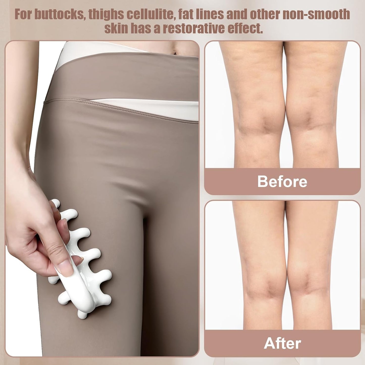 Vemoky Fascia Blaster for Cellulite Trigger Point Massage Tool Anti Cellulite Massager Tool Reaching Deep Myofascial Tissue Throughout The Body Release Muscle Knot Reduction Cellulite Tightening Skin