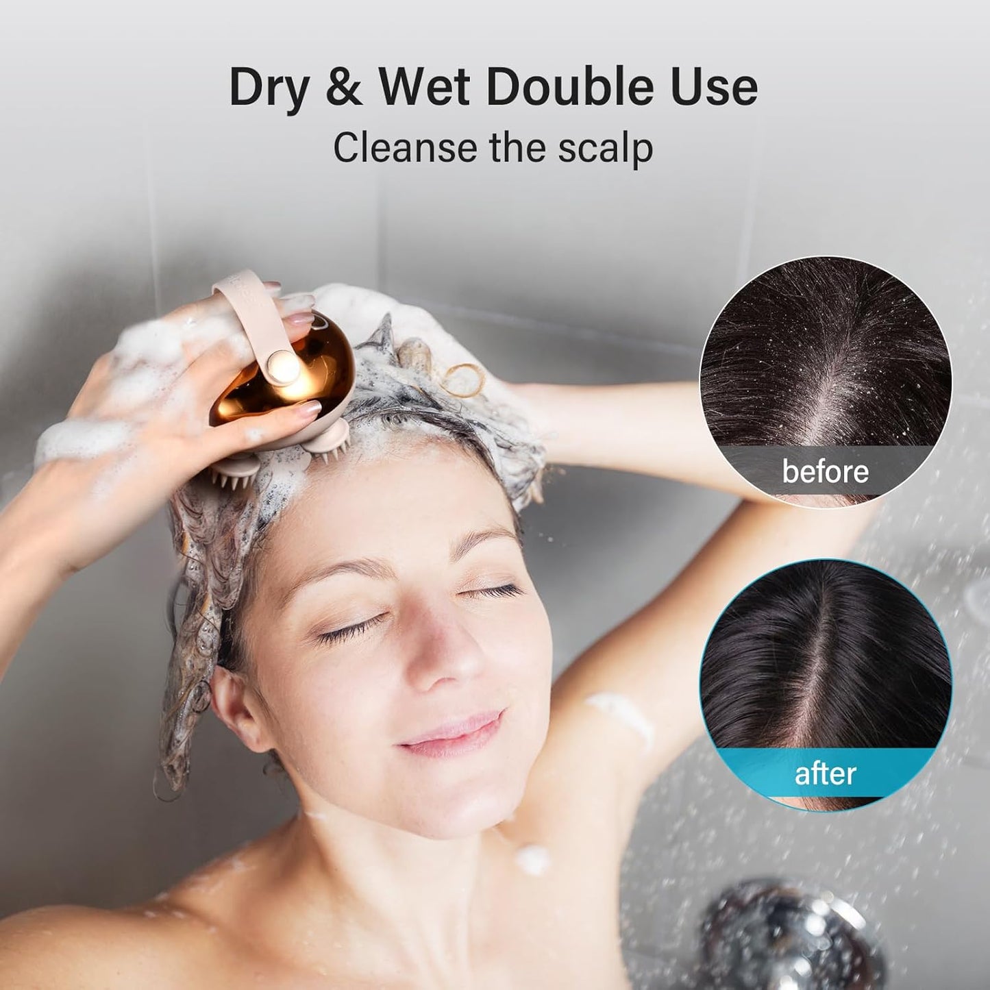 arboleaf Electric Scalp Massager Head Massager Scalp Stress Relax, 5 in 1 Kneading 128 Massage Nodes, Waterproof Hair Massage with 8 Removable Claws Cat Scratcher