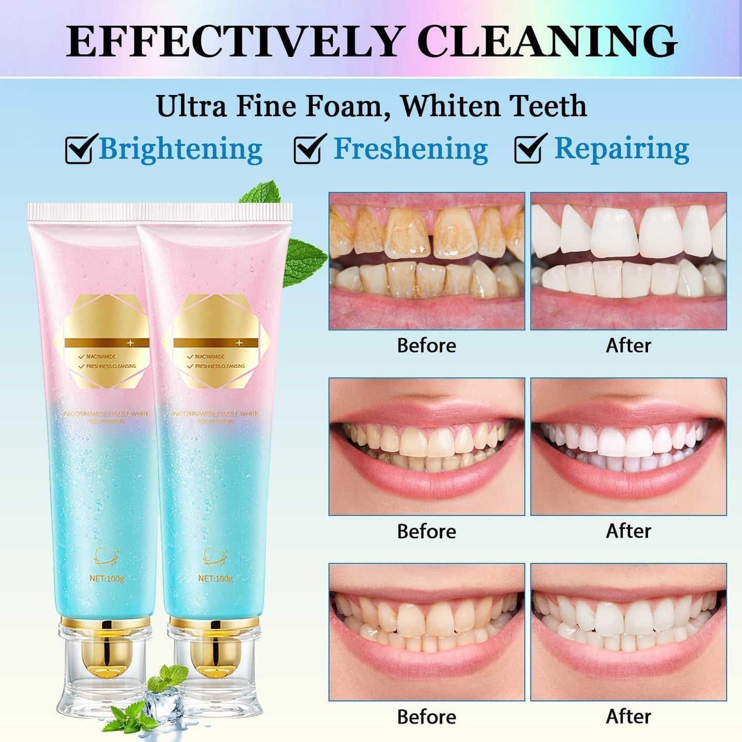 Bodyacel Toothpaste,Niacinamide Whitening Toothpaste,Whitening Toothpastes Stain Removal,Stain Removal Natural, Complete Care, Enamel Repair, Fresh Breath, Protect and Bright Teeth (3 PCS)