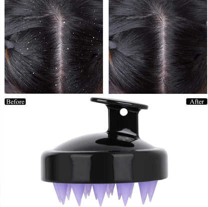 2 Pcs Hair Shampoo Brush Scalp Scrubber Shower Head Care Massager for Washing Dandruff Remove Hair Growth for Women, Men, Pets