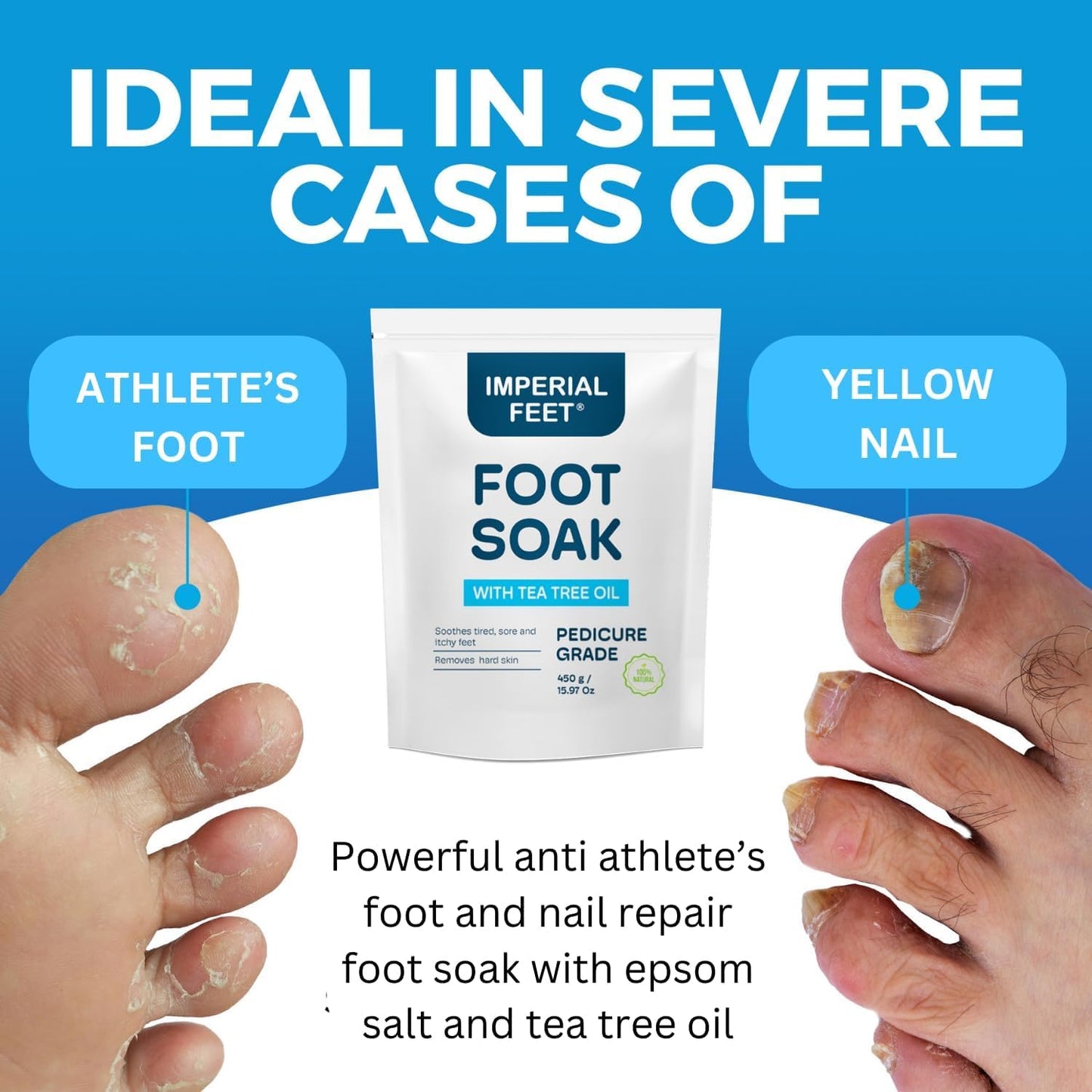 Pedicure Quality Foot Soak with Tea Tree Oil & Epsom Salt | Helps Treat Nail Fungus Athletes Foot | Anti Fungal Nail Treatment | Foot Moisturiser & Deodorizer Feet Soak | Exfoliating Foot Soak