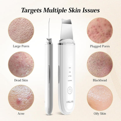 ANLAN Professional Ultrasonic Skin Scrubber for Deep Cleansing Face Peeling and Care, 4 Modes Blackhead Removal, USB Rechargeable