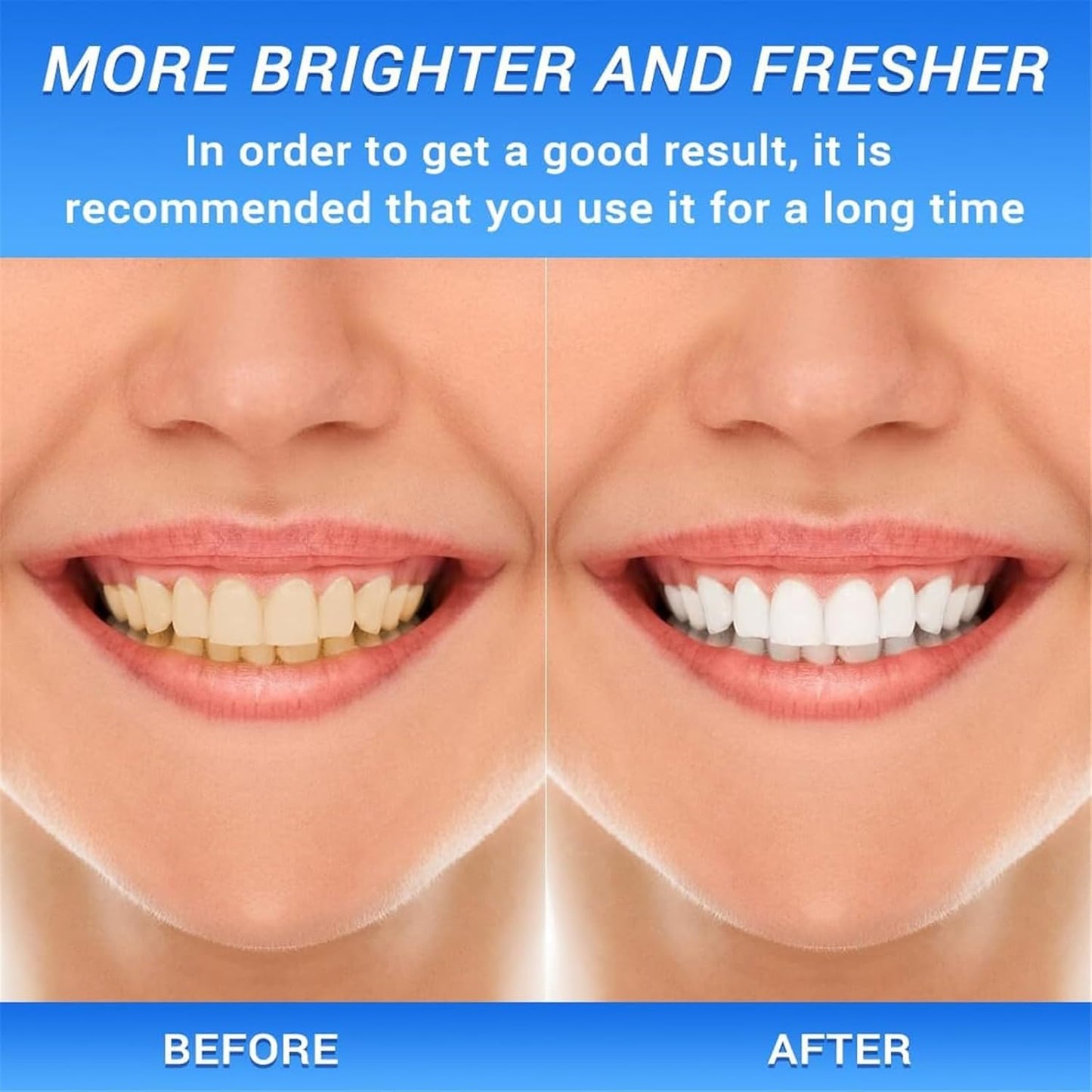 Niacinamide Whitening Toothpaste, Fresh Breath Complete Care Teeth, Remove Tooth Stains, Nicotinamide Sparkling Toothpaste (1)