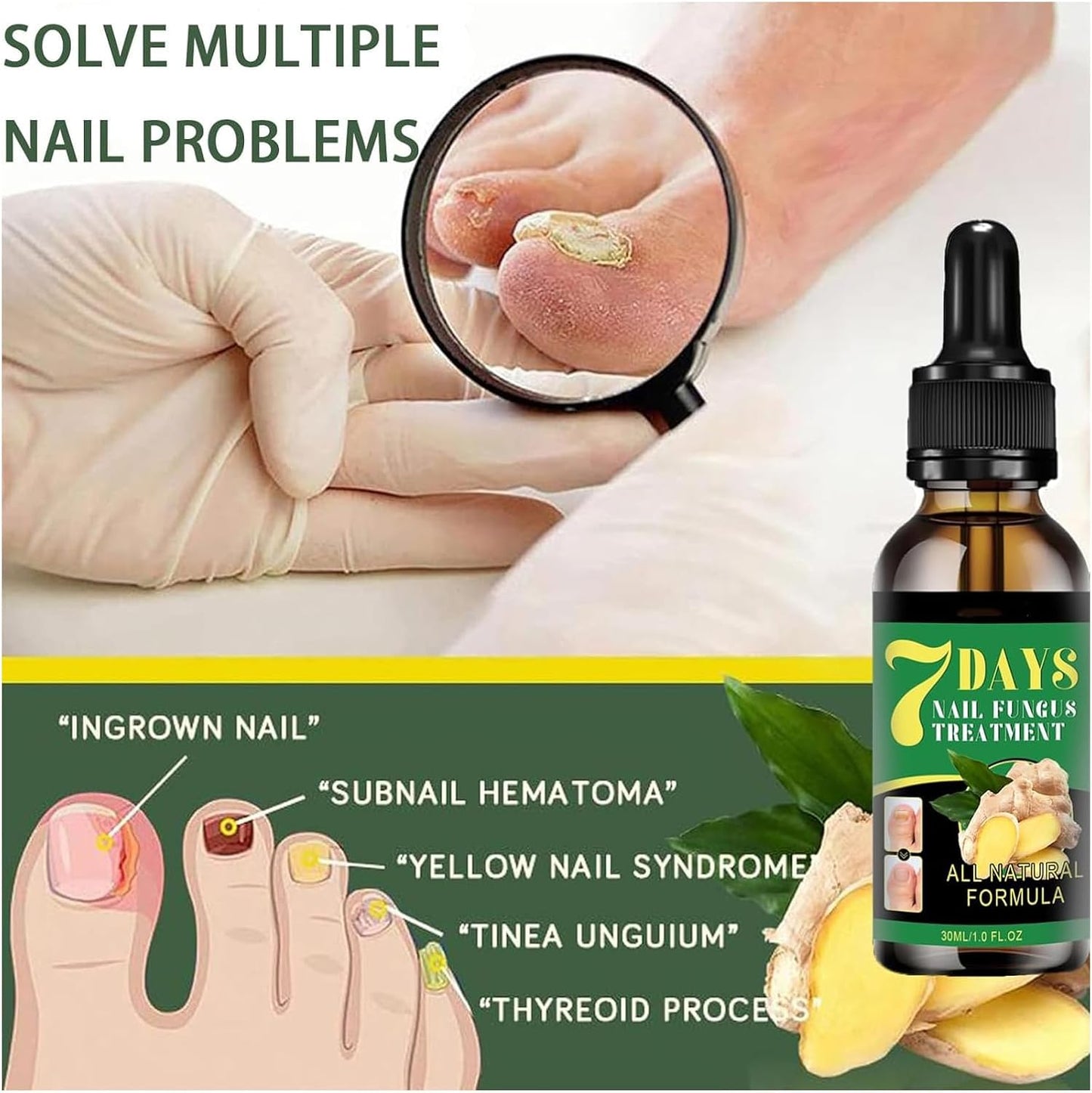 Ginger Growth Care Serum，Helps Nails Healthy Grow (2pcs)