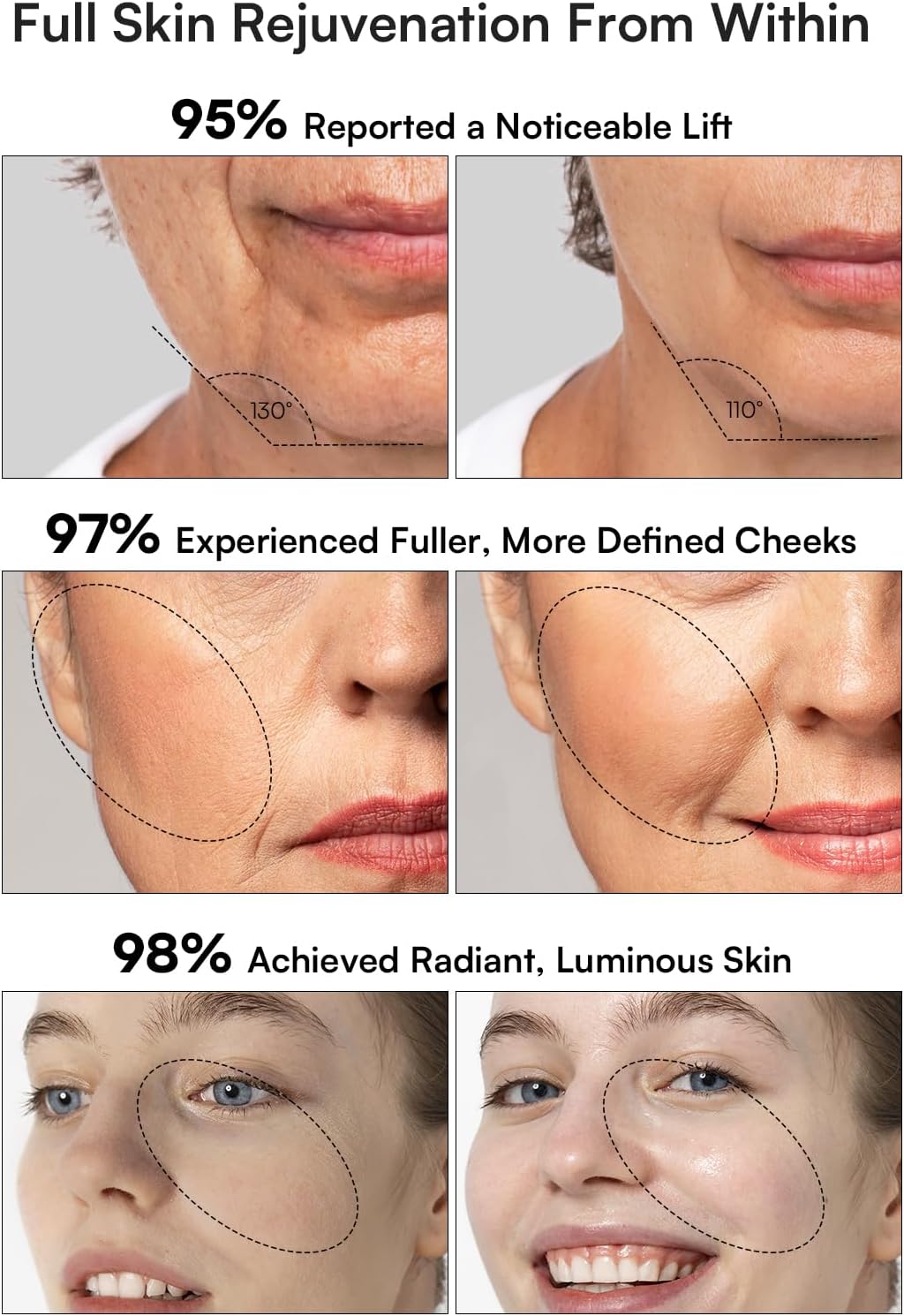 INIA 3-in-1 Red Light Therapy for Face and Neck, Skin Tightening Device True Beauty Glow Facial Massager for Skin Care, Effective Wrinkle Reduction Anti-Aging with Lifting, Tightening, Infusing