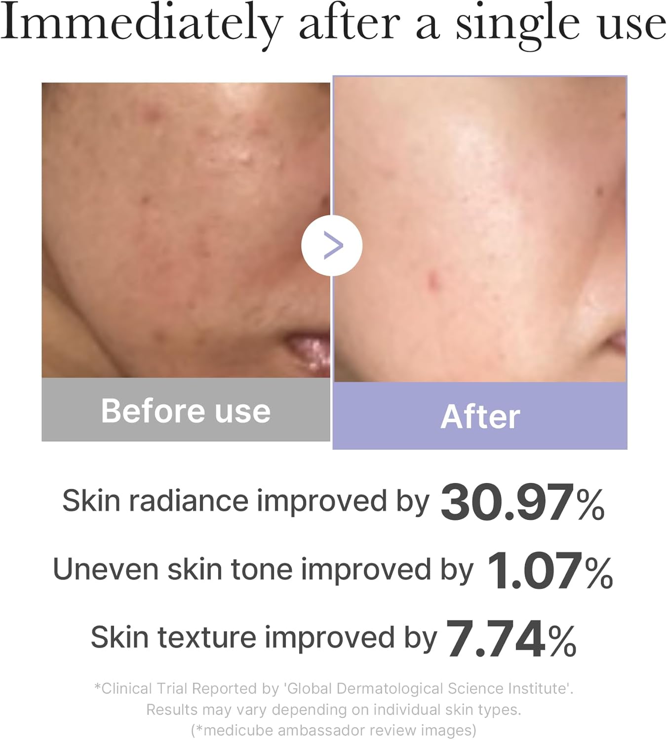 medicube Mini Booster Pro Pink | Affordable At-Home Facial Skin Care Tool for Beginners - Portable Glow Booster for Glass Skin, Boosting Skin Care Absorption, Skin care for teens, Korean Skin Care