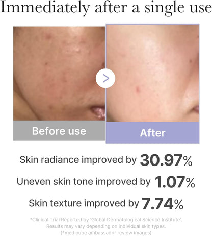 medicube Mini Booster Pro Pink | Affordable At-Home Facial Skin Care Tool for Beginners - Portable Glow Booster for Glass Skin, Boosting Skin Care Absorption, Skin care for teens, Korean Skin Care