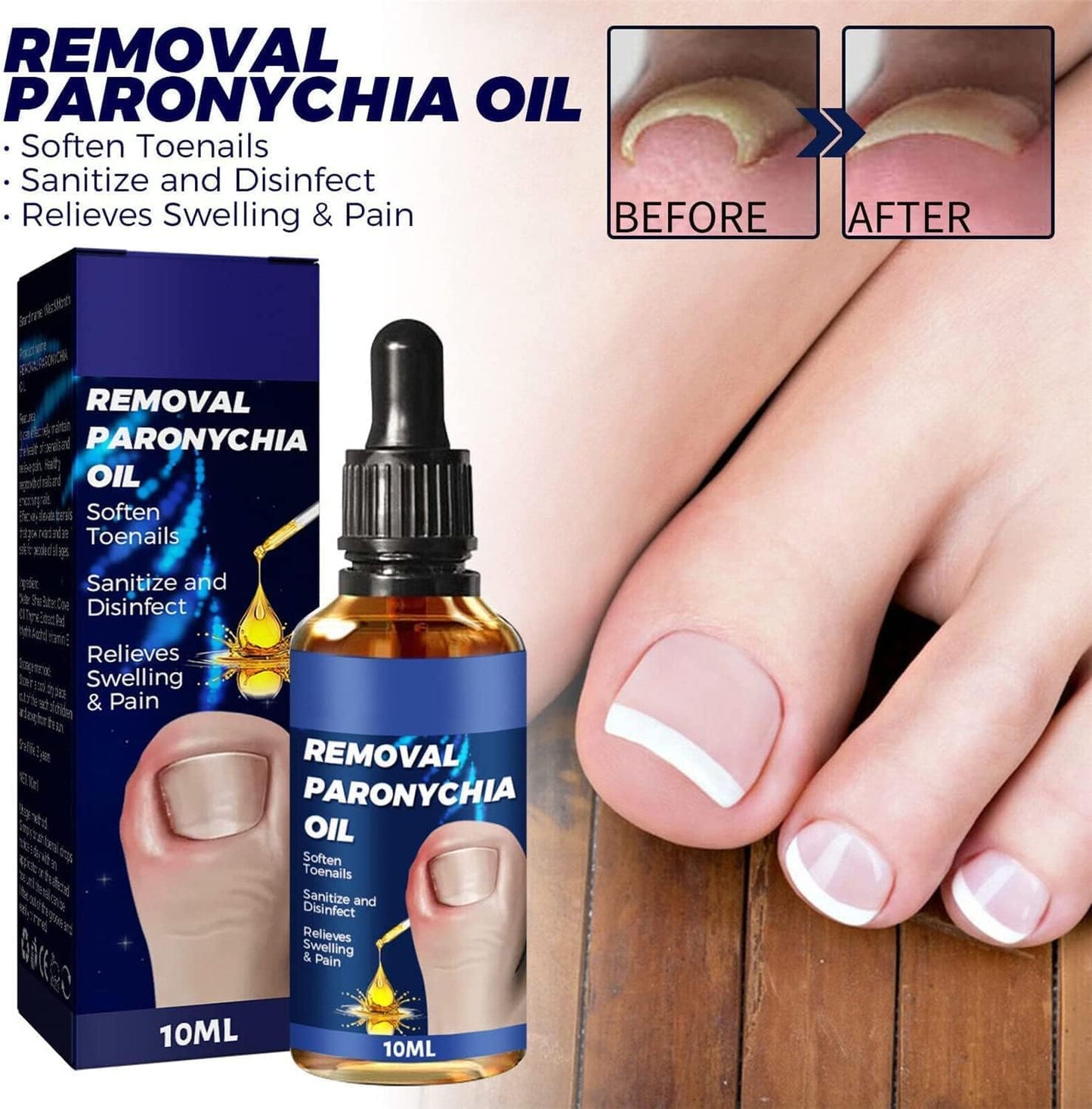 German Toenailcare Removal Paronychia Oil, Care Oil for Removing Paronychia, Toenail Treatment Best Nail Repair Solution,Nail Renewal Liquid for Damaged & Discoloration Nail (2 Pieces)