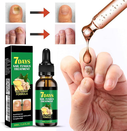 Ginger Nail Treatment Nail Support Nail Care, 7Days Nail Treatment Serum, Multipurpose Nail Repair, Ginger Nail Growth Serum, Nourishing Strengthening Nail Oil (1 PC)