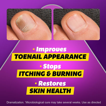 SILKA Max Strength Antifungal Liquid for Toenail Health with Brush Applicator, Results in 1 Week, Nail Fungus Treatment for Damaged Toenails, Athlete's Foot Treatment, Tolnaftate 1% 0.45 Fl Oz