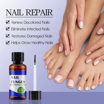 Apooliy 30ML Toenail Fungus Treatment Extra Strength, Powerful Nail Care Renewal & Recovery Liquid for Thick, Damaged & Discolored Nails Remedy