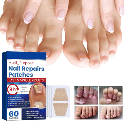 Nail Repair Patches, 60 Pieces Long-Lasting Nails Care Patch, 20g Breathable Toenail Sticker, Ideal for Recovery Restoration, Home, Travel, Adults, Professional, Beginners