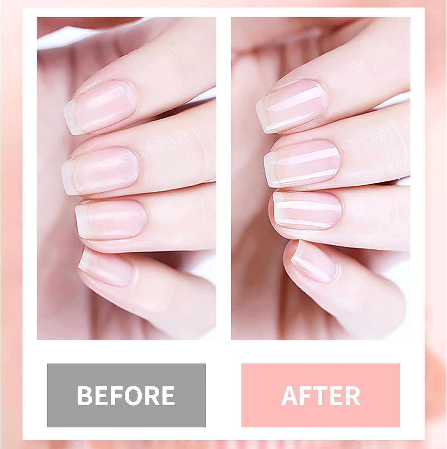 Nail Cuticle Oil Nail Repair Nail Hardener Nail Strengthener Nail Rescue Calcium Primer for Thin Nails Growth Nail Repair Nail Care Kit with Cuticle Oil Cuticle Remover Gel Cream 4in1