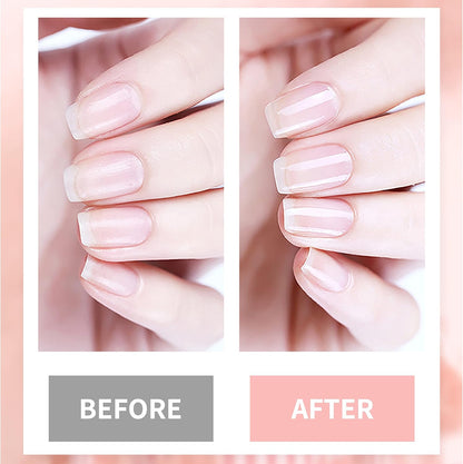 Nail Cuticle Oil Nail Repair Nail Hardener Nail Strengthener Nail Rescue Calcium Primer for Thin Nails Growth Nail Repair Nail Care Kit with Cuticle Oil Cuticle Remover Gel Cream 4in1