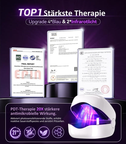 LOZLTX 4.0 Quality Nail Mushroom Laser & Stopwatch & Fruity Nail Care Pen【Stronger Fast Acting Therapy】Nail Mushroom Laser Device 【SGS Approved Safe and Reliable】Improved