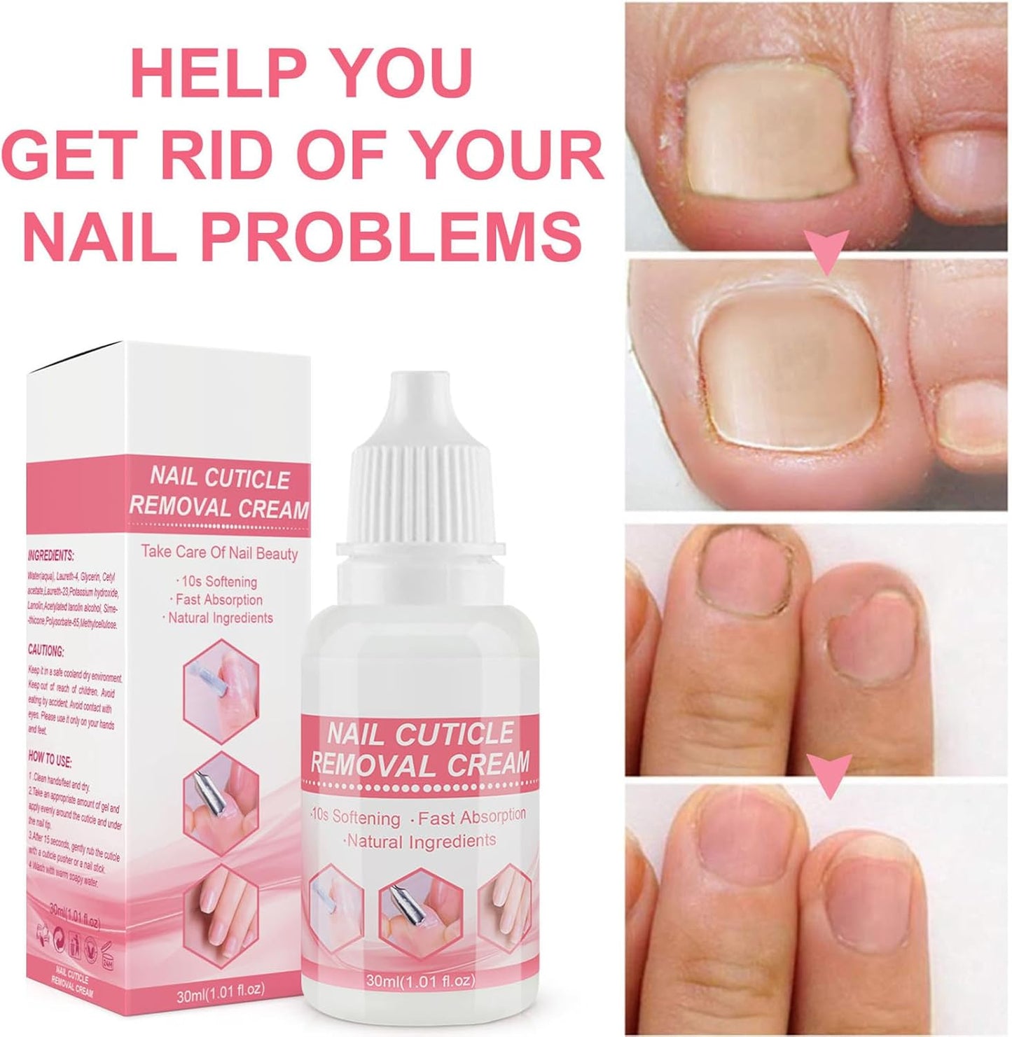 Cuticle Cream, Nail Softener, Skin Moisturizer, 3.35x1.14x3.35 inches Hydrating Formula, Strength Repair Solution, Daily Hand Care for Dry Fingers, Damaged Tips, Dead Procedure