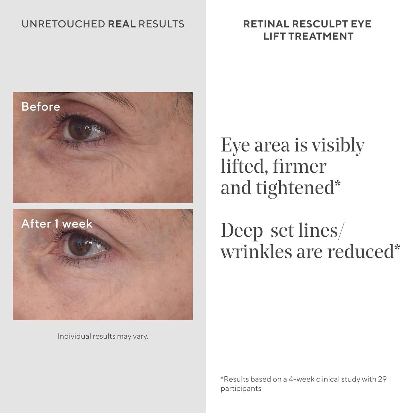 Murad Retinal ReSculpt Eye Lift Treatment - Resurgence Anti-Aging Eye Serum for Lines and Wrinkles - Encapsulated Vitamin A Eye Cream that Firms, Lifts, and Improves Sagging, 15ml