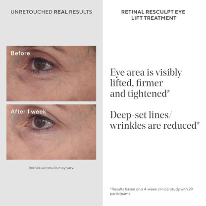 Murad Retinal ReSculpt Eye Lift Treatment - Resurgence Anti-Aging Eye Serum for Lines and Wrinkles - Encapsulated Vitamin A Eye Cream that Firms, Lifts, and Improves Sagging, 15ml