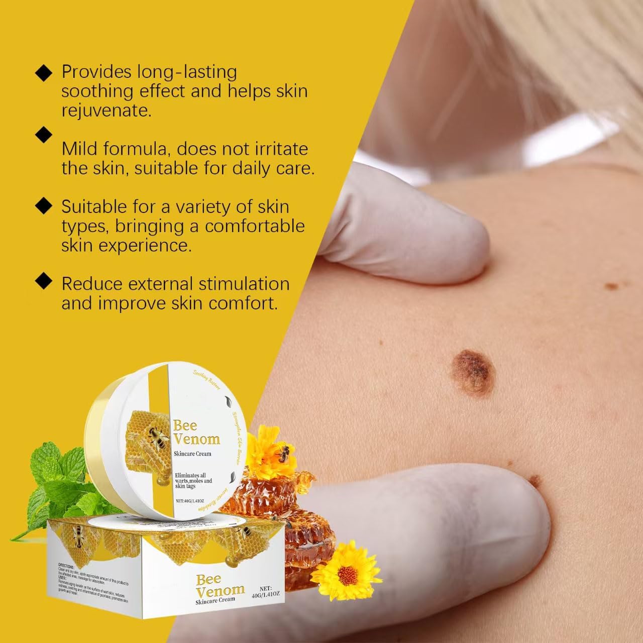 2Pcs Bee Venom Cream,Bee Venom Comprehensive Cream,Bee Venom Wart And Mark Removal Treatment,Face Moisturizer,Anti Inflammatory And Skin Nourishment Cream,Anti Aging Cream