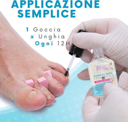 Antifungal Nail Feet and Hands 12 ml – Treatment Prevents Mycosis/Fungi and Restores the Natural Appearance of the Nail.