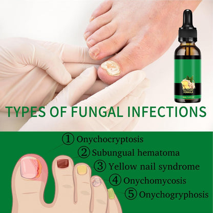 Mimoqk Organic Nail Growth Oil, 60 ml Portatile Strengthener, Professional Cuticle Care Solution, Toenail Repair Liquid, Repairing and Thickening Formula for Healthy Nails