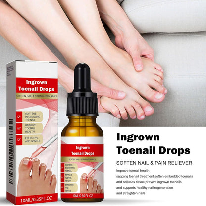 Ingrown Toenail Treatment Drop - Ingrown Toenail Treatment- Cuticle Care Oils for Ingrown Toenails - Trimming Toenail Softening Drops Natural Ingrown Toenail Correction Fungal Nail - 10ml