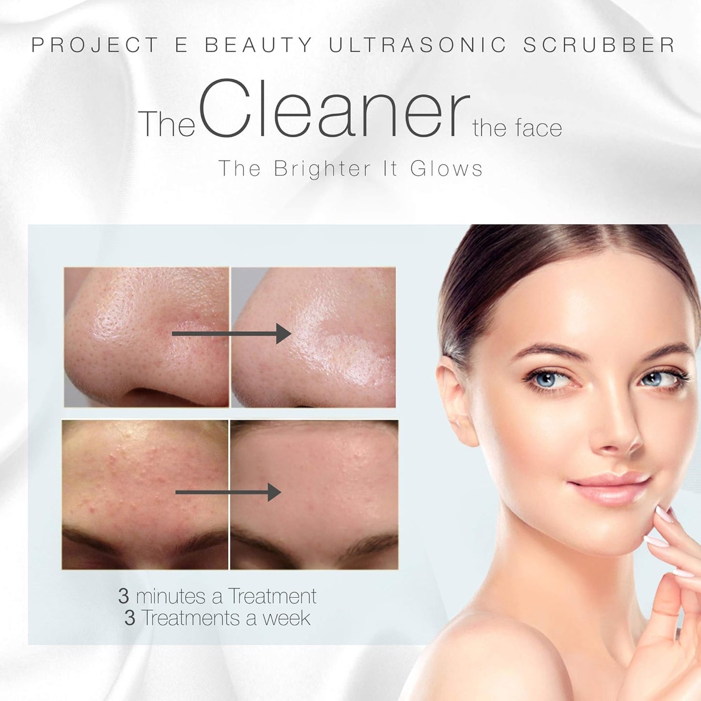 Wireless Ultrasonic Skin Care Scrubber by Project E Beauty | Skin Spatula | Gentle Exfoliation | Removes Blackheads | Deep Pore Cleansing | Dead Skin Remover | Smoother Complexion