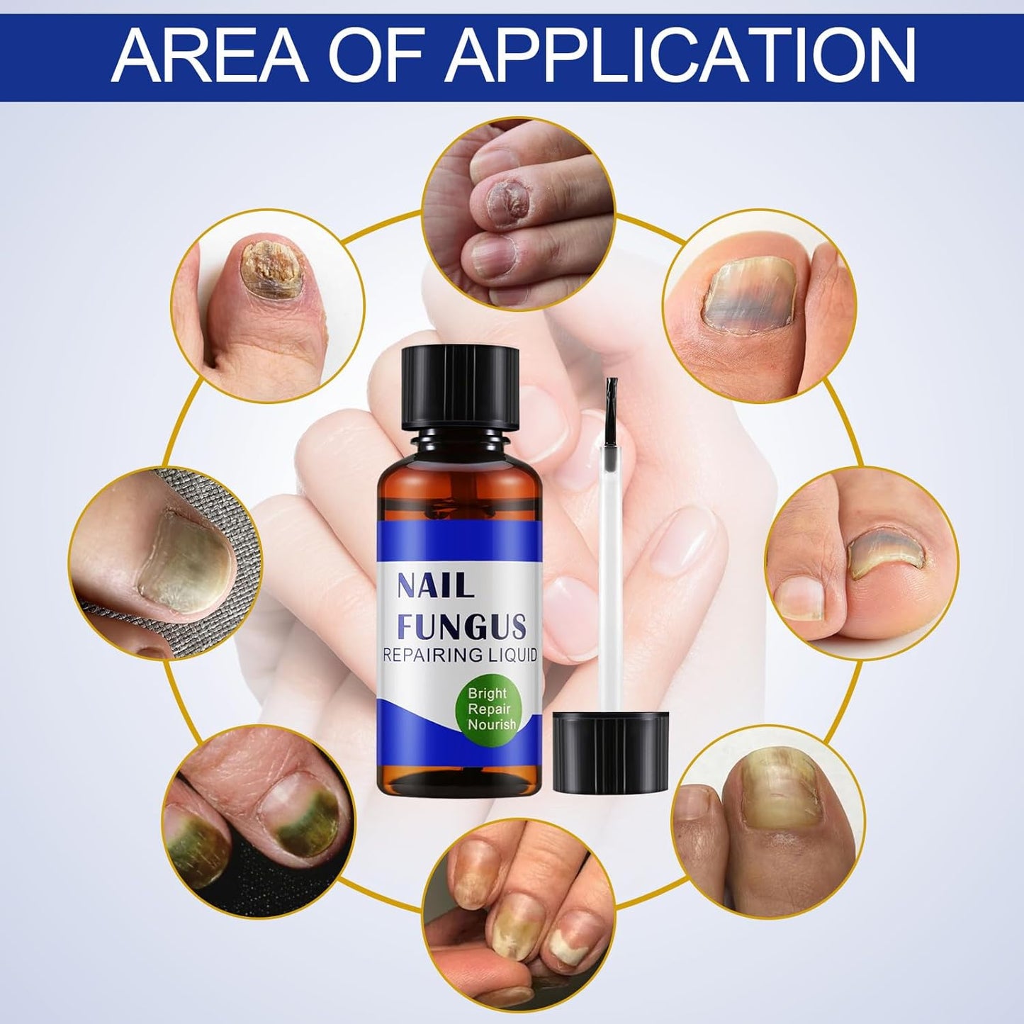 Apooliy 30ML Toenail Fungus Treatment Extra Strength, Powerful Nail Care Renewal & Recovery Liquid for Thick, Damaged & Discolored Nails Remedy