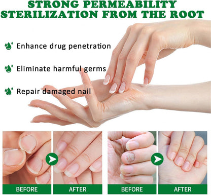 Mimoqk Organic Nail Growth Oil, 60 ml Portatile Strengthener, Professional Cuticle Care Solution, Toenail Repair Liquid, Repairing and Thickening Formula for Healthy Nails