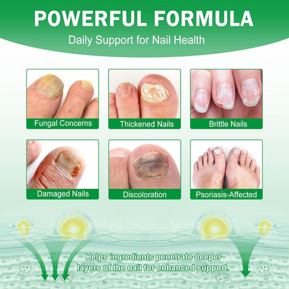 7 Day Nail Fungus Treatment | Natural Plant-Based Nail Repair Oil with Ginger Extract | Strengthens & Nourishes Nails & Cuticles | Repairs Discolouration & Brittleness | Suitable for Hands & Feet | 60mL