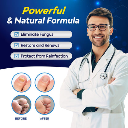 Toenail Fungus Treatment with 25% Undecylenic Acid, Toe Fungus Treatment for Toenail, Fungus Nail Treatment, Toenail Fungus Treatment Extra Strength, Fungal Nail Treatment for Athletes Foot (1oz)