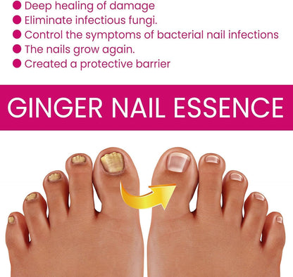 Fungigone Nail Treatment, Fungal Nail Care Strong Removal, Nail Repair Growth Treatment, Nail Softener for Thick Toenails Toe and Finger Nail Solution (1PCS)