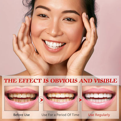 SP-8 Probiotic Toothpaste, SP-8 Ultra Whitening Toothpaste, Fresh Breath, Deep Cleaning Care Toothpaste, Oral Care, 3 PCS