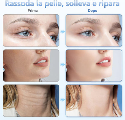 Electric Face Massager, Lifting Face Massager with 6 Modes at 45°C for Anti-Aging, Lifting and Firming Sagging Skin (4 Colour LED Mode - White)