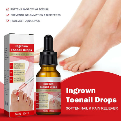 Ingrown Toenail Treatment Drop - Ingrown Toenail Treatment- Cuticle Care Oils for Ingrown Toenails - Trimming Toenail Softening Drops Natural Ingrown Toenail Correction Fungal Nail - 10ml