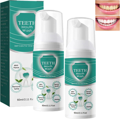 Jorondy Teeth Mouthwash, Teeth Whitening Mousse Foam, Deeply Cleaning Stain Removal Teeth Whitening Toothpaste, Mouth Wash Water, Oral Care Fresh Breath 60ml (2 Pack)