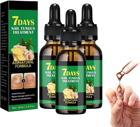 7 Days Ginger Nail Ginger Nail Treatment Nail Support Nail Care, Ginger Nail Growth Serum, Ginger Cuticle Care Oil for Nails, Nail Nutrient Oil Strengthener Oil (3 PCS)