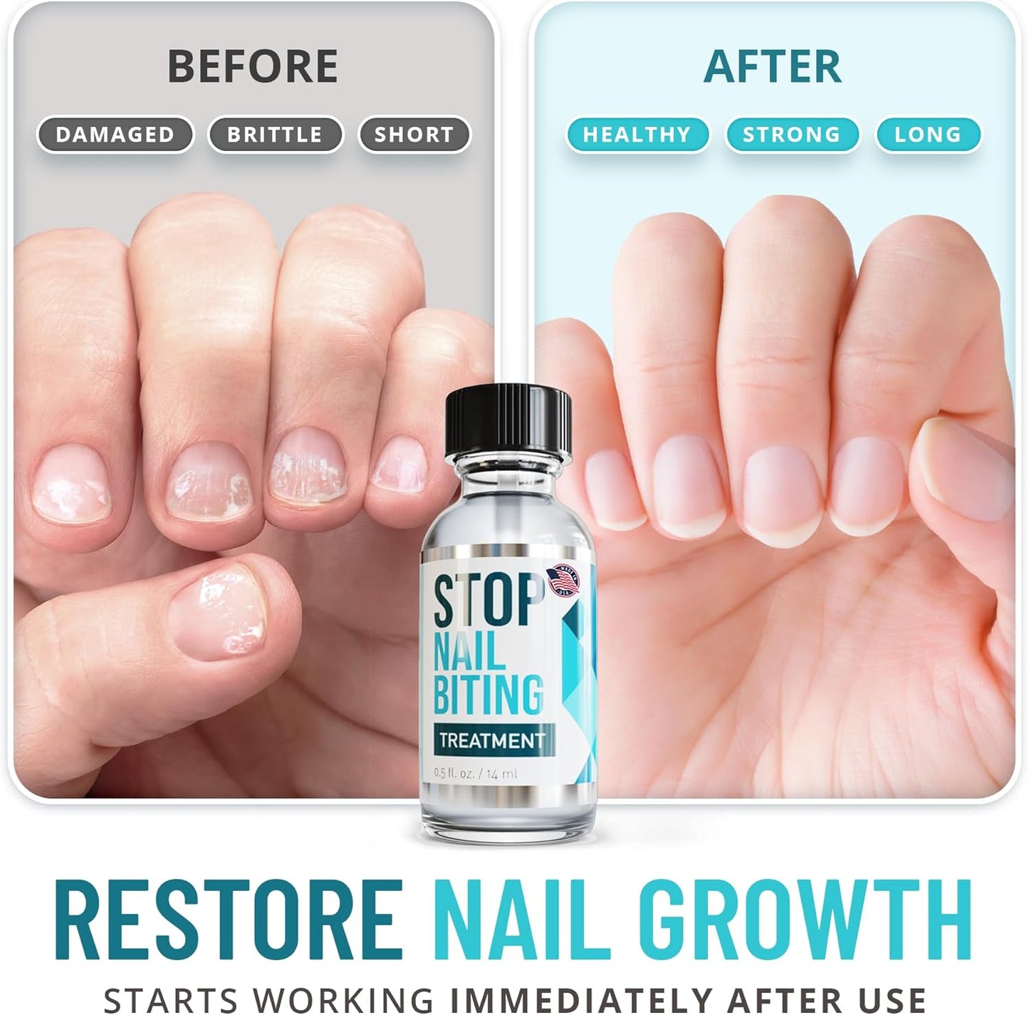Stop Nail Biting Treatment - Clear, Bitter-Tasting Nail Polish To Stop Nail-Biting - Easy To Apply and Safe For Children - Nail Strengthener Solution - Nail Care for Healthy Nail Growth (0.5 fl oz)