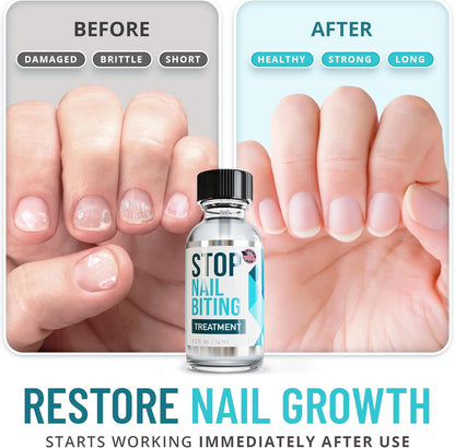 Stop Nail Biting Treatment - Clear, Bitter-Tasting Nail Polish To Stop Nail-Biting - Easy To Apply and Safe For Children - Nail Strengthener Solution - Nail Care for Healthy Nail Growth (0.5 fl oz)