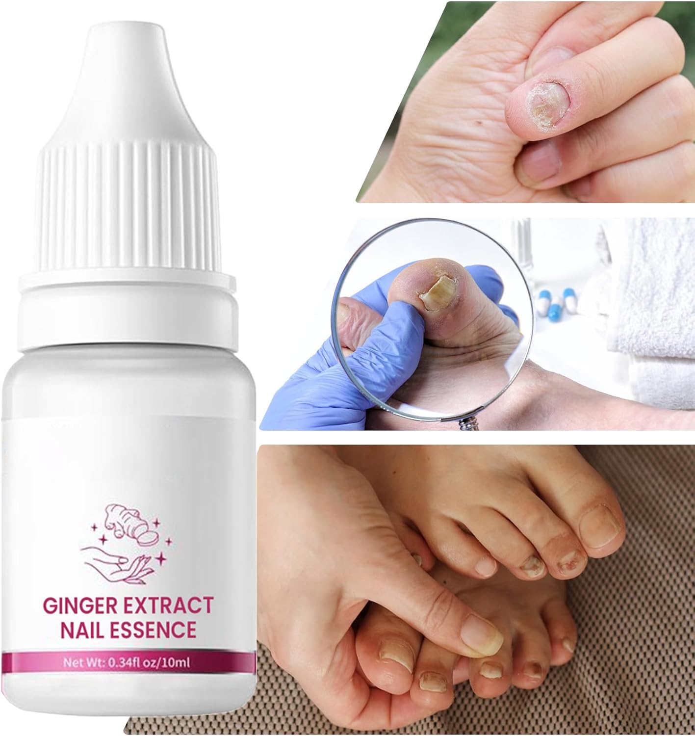 Nail Hardener, Nail Nutrient Oil, 10 ml Natural Cuticle Oils Repair Softener, Optimal Nail Revitalization, for Foot Care, Fingernails, Yellow Toenail, Men Ingrown, Women and