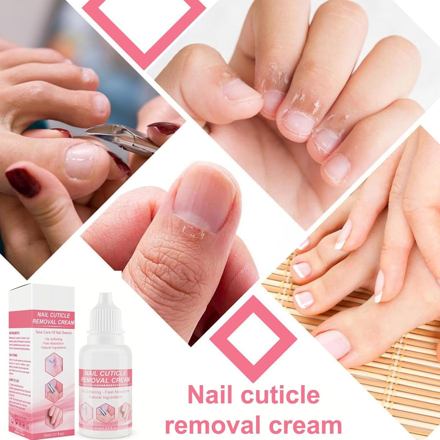 Cuticle Lotion, Cuticle Cream, Moisturizing Professional Softener Remover, Hydrating Strengthens Softens Dry Dead Skin, Nails Care Therapyfor Overgrown Moisturizer, 3.35 Inches