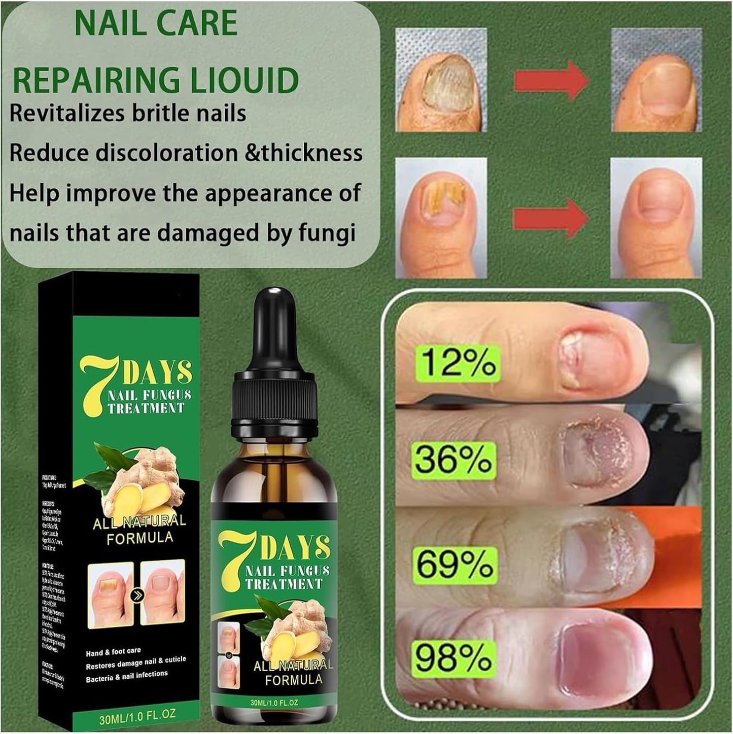 Ginger Growth Care Serum，Helps Nails Healthy Grow (2pcs)