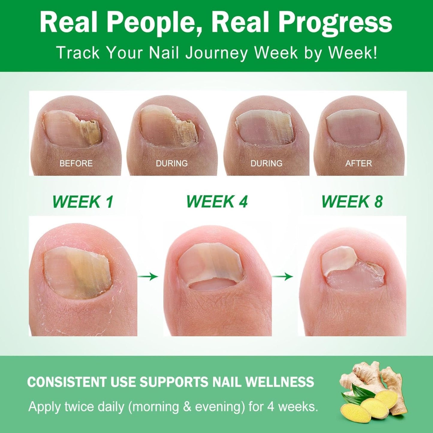 Ginger Nail Growth Serum,Ginger Nail Treatment Nail Support Nail Care,Nail Nutrient Oil Strengthener Oil,Nourishing Idratante