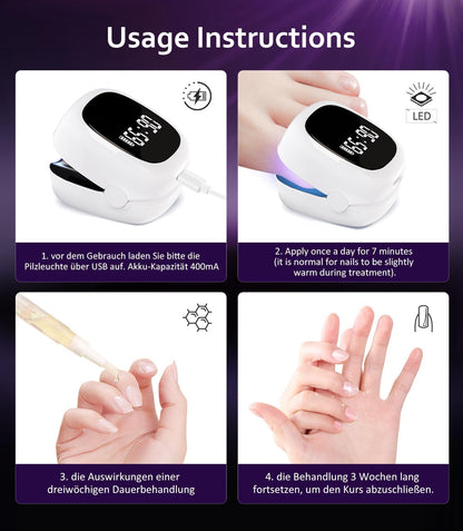 LOZLTX 4.0 Quality Nail Mushroom Laser & Stopwatch & Fruity Nail Care Pen【Stronger Fast Acting Therapy】Nail Mushroom Laser Device 【SGS Approved Safe and Reliable】Improved