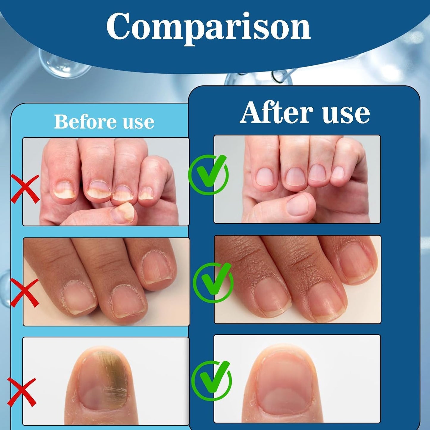 4 Pcs Nail Care with Nail File, Cuticle Oil, Nail Care Pencil with Aloe Vera for Nails and Toenails