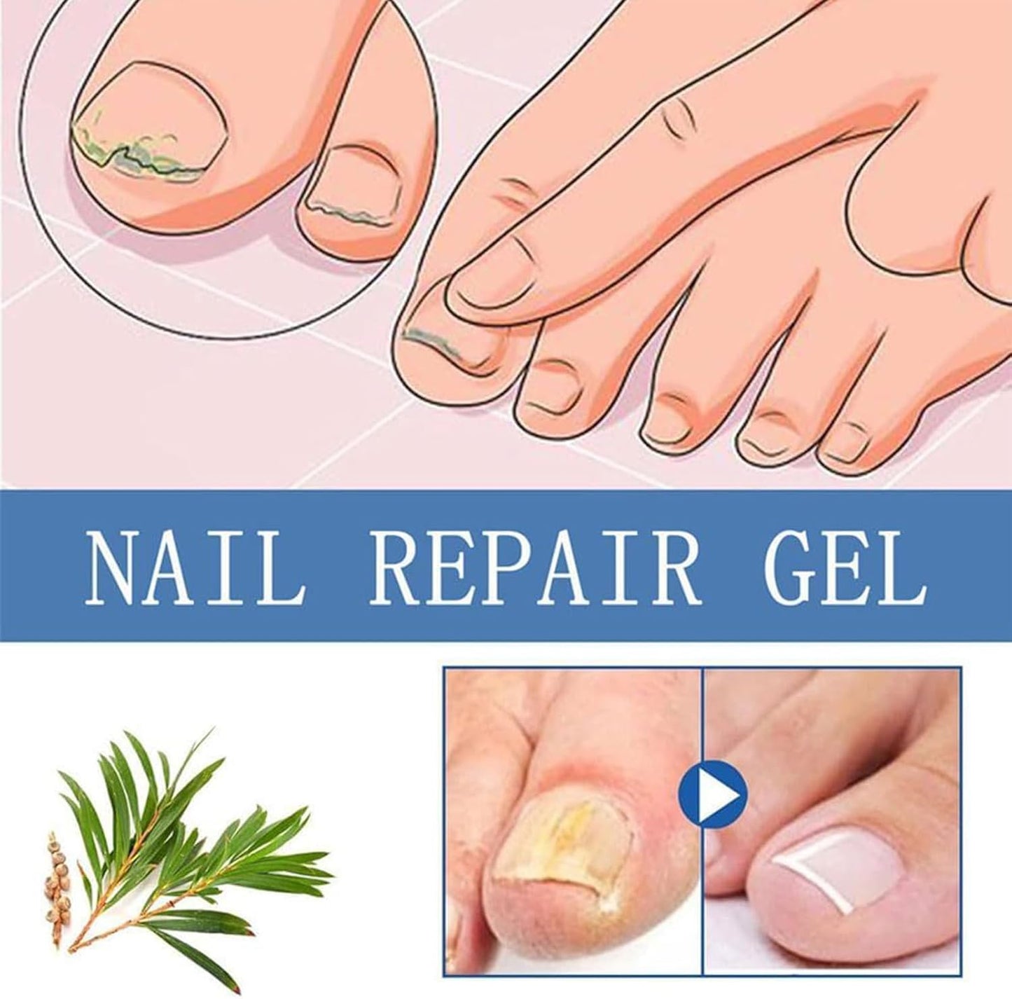 Nail Strengthener Gel Deep Nutriishing Toenail Trattamenti, 30 ml Moisturizing Nail Care, Idratazione Formula, Quick Absorption for Women, Seniors, Men, Post-Workout, Travel, Home