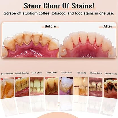 Plaque Remover for Teeth, Electric Tooth Cleaner Tartar Remover for Teeth with LED Light,4 Modes Rechargeable Teeth Cleaning Kit with Dental Tools, 2 Replaceable Heads (White A)